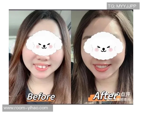 亚马尔自信分享戴牙套体验称其外观与自我形象完美契合